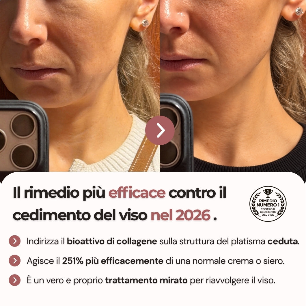 Khelopatra | Kit anti - cedimento 2.0 | Effetto lifting dal primo trattamento