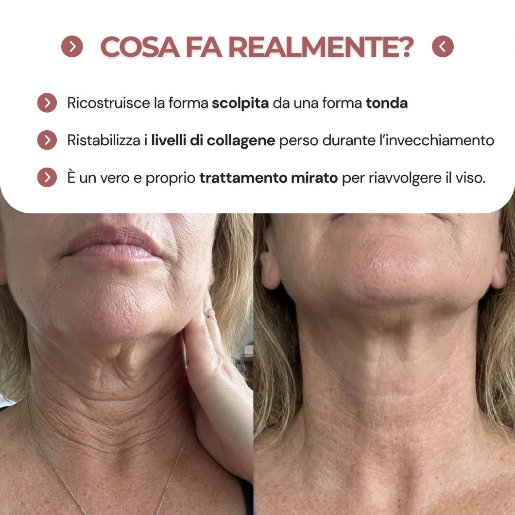 Khelopatra | Kit anti - cedimento 2.0 | Effetto lifting dal primo trattamento