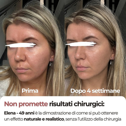 Khelopatra | Kit anti - cedimento 2.0 | Effetto lifting dal primo trattamento