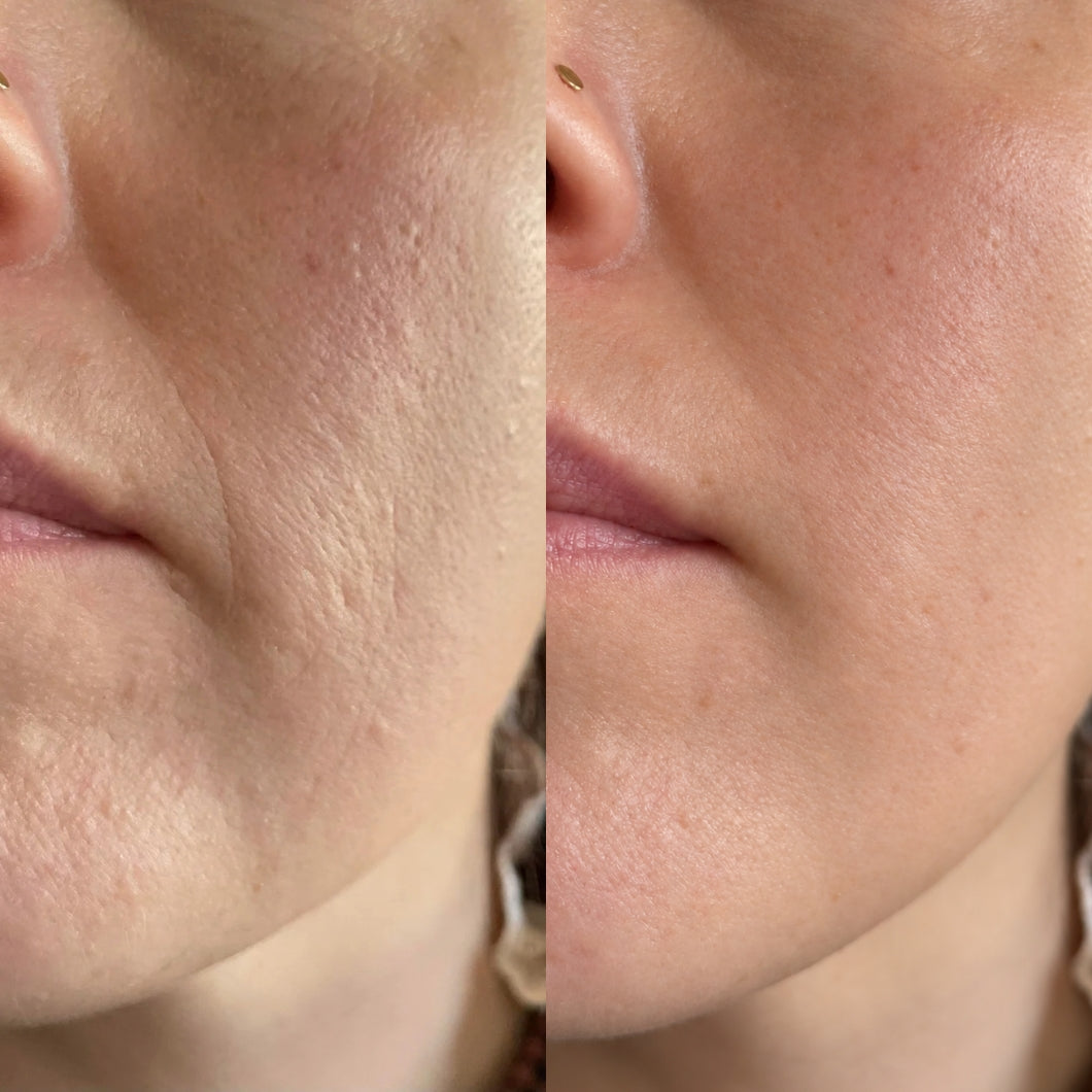 Donna con maschera viso