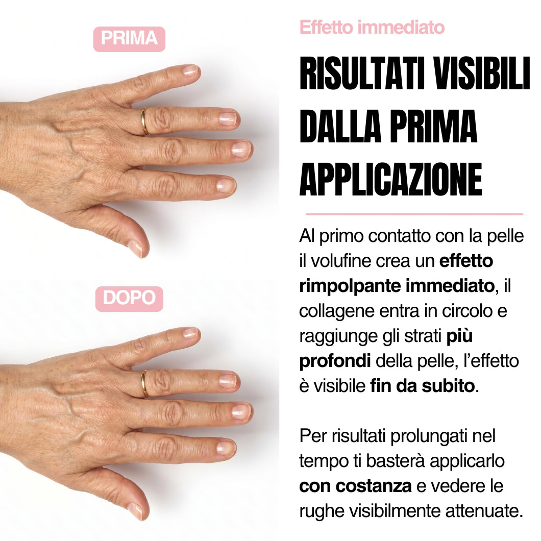 Stick Rimpolpante mani - Voliufiline 5%
