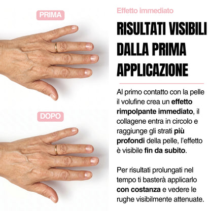 Stick Rimpolpante mani - Voliufiline 5%