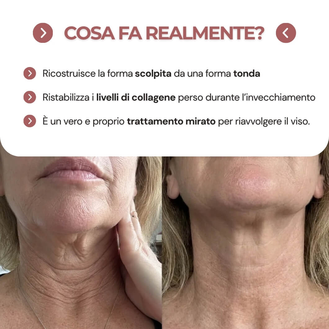 khleopatra - dispositivo di compressione a rilascio collagene 300 dalton